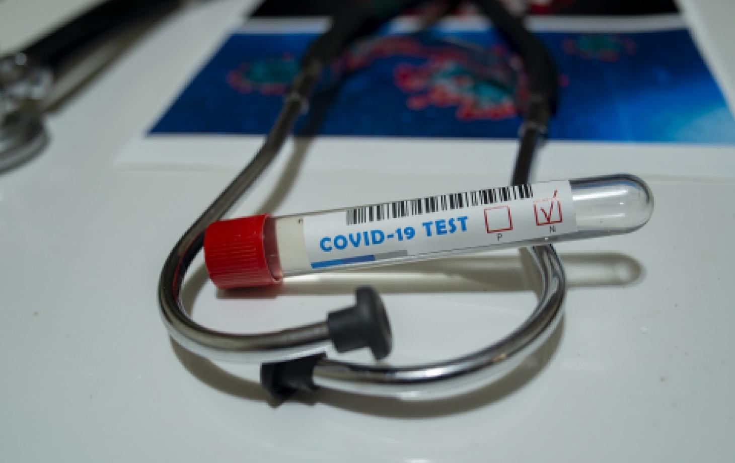 Почти четверть всех заболевших — в возрасте от 50 до 59 лет. Последние данные по коронавирусу